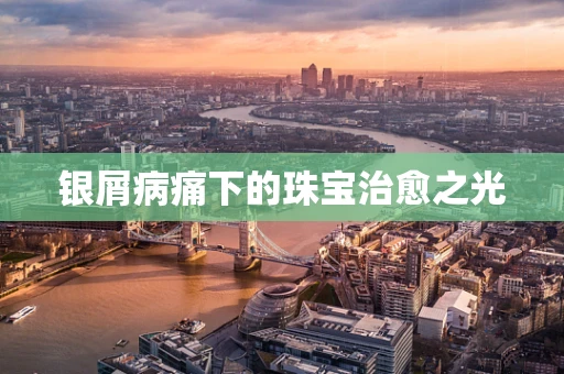 银屑病痛下的珠宝治愈之光