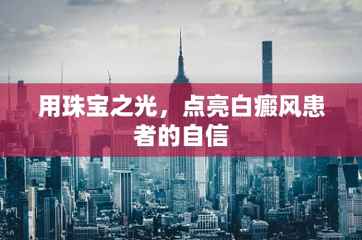 用珠宝之光，点亮白癜风患者的自信